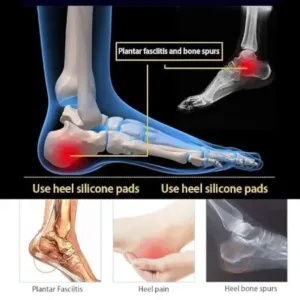 Silicone Heel Protector Cups for Cracked Heels | Soft Gel Heel Support Pads for Heel Pain Relief & Foot Care ( default, Standard )
