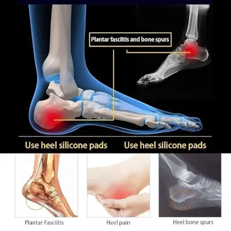 KkOm5yGanZ3GY9fnPcVSaJ9tQ62rlNVbd6ZJo8Vk.webp Silicone Heel Protector Cups for Cracked Heels | Soft Gel Heel Support Pads for Heel Pain Relief & Foot Care ( default, Standard )