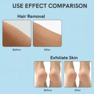 Nano Hair Remover for Arms, Legs, Back One Sided Skin Hair Remover (1 Pc) ( default, Standard ).